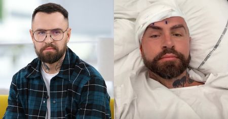 Łukasz Urbański przeszedł operację usunięcia guza mózgu. Fryzjer gwiazd pokazał zdjęcie po zabiegu