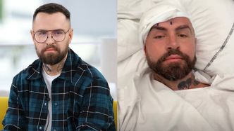 Łukasz Urbański przeszedł operację usunięcia guza mózgu. Fryzjer gwiazd pokazał zdjęcie po zabiegu