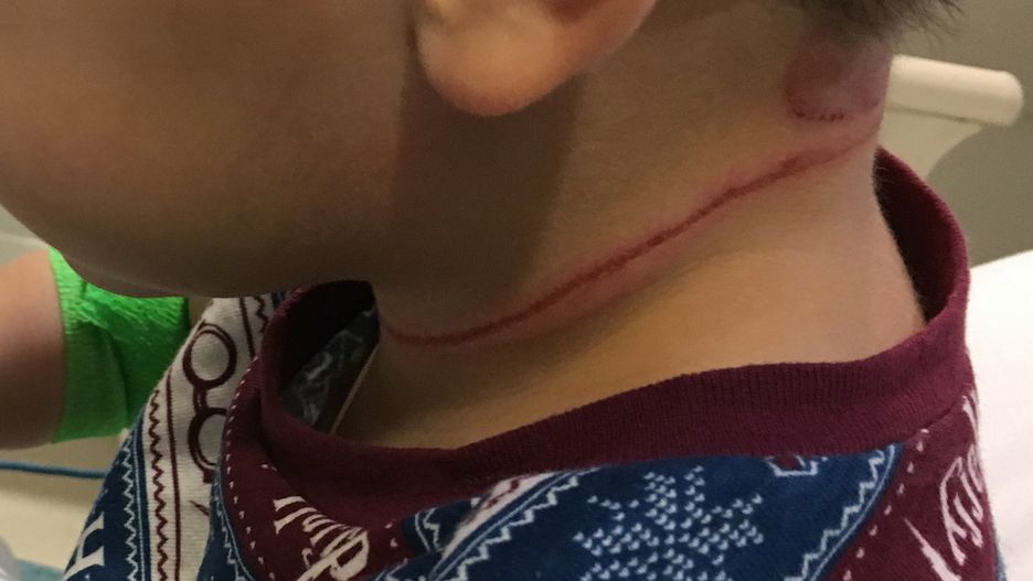 3-letni Kai omal nie umarł przez sznurek od żaluzji