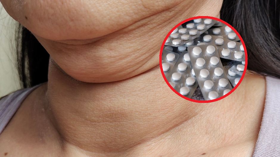 Szturm na apteki. Polacy na własną rękę robią zapasy płynu Lugola i jodku potasu