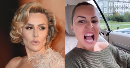 Walcząca o hollywoodzki uśmiech Blanka Lipińska broni swojej "spuchniętej twarzy"
