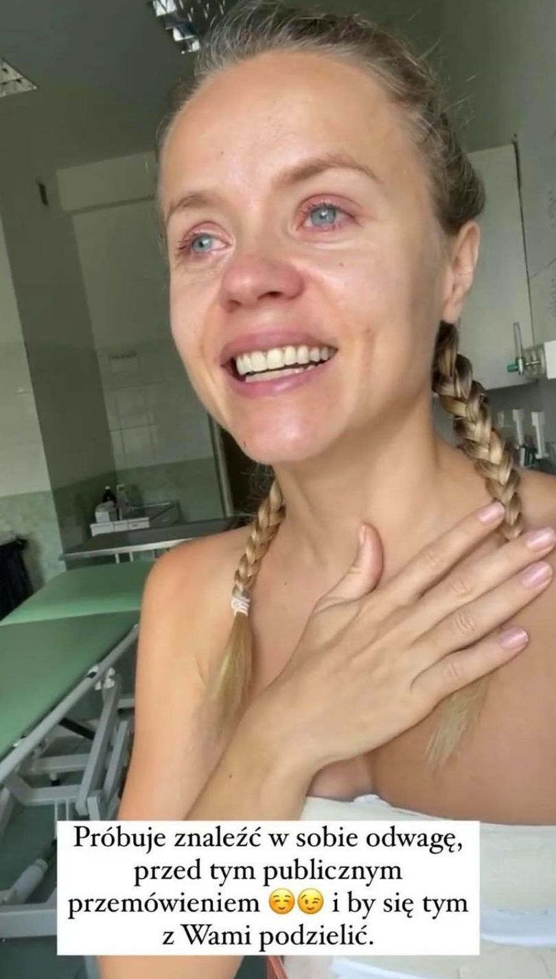 Anna Skura otwiera się na temat operacji