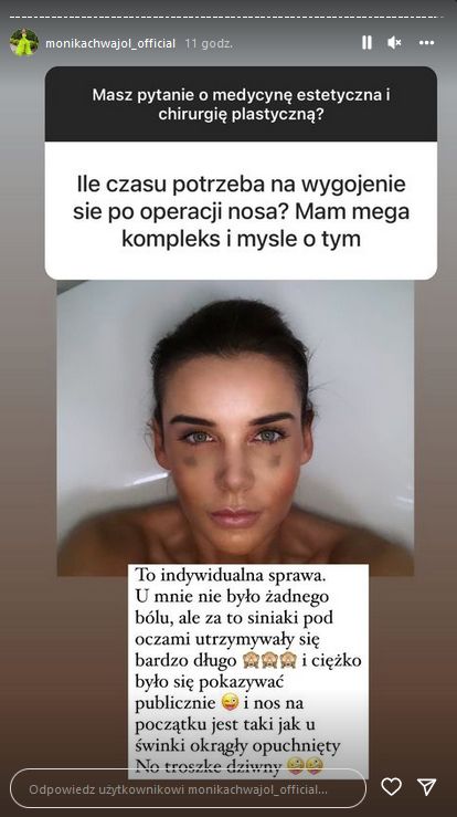 Monika Chwajoł pokazała stare zdjęcia i opowiedziała o operacjach