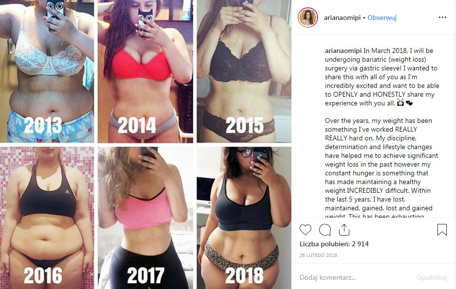 Ariana nie mogła zapanować nad swoją wagą. Wciąż chudła i tyła. 