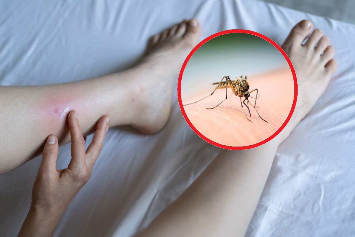 Co najlepiej odstraszy komary?