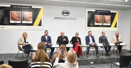 Laseroterapia skutecznie wspomaga farmakologię w leczeniu chorób skóry