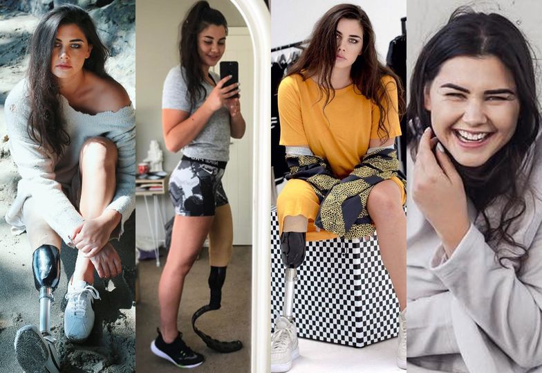 Jess Quinn - nowozelandzka "influencerka" z protezą nogi