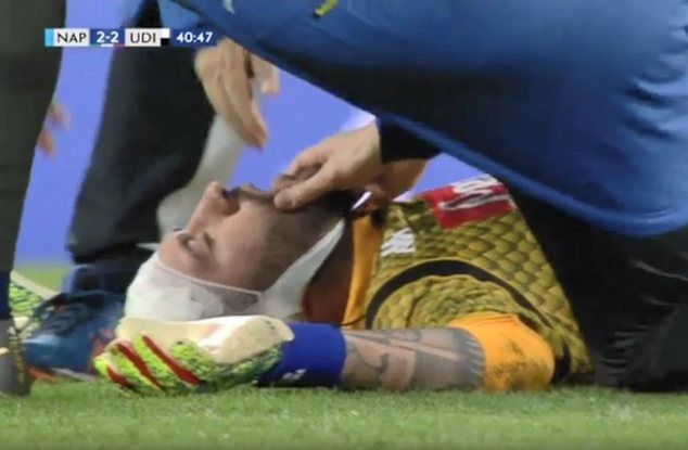 David Ospina stracił przytomność w czasie meczu Napoli - Udinese (fot. Eleven Sports)