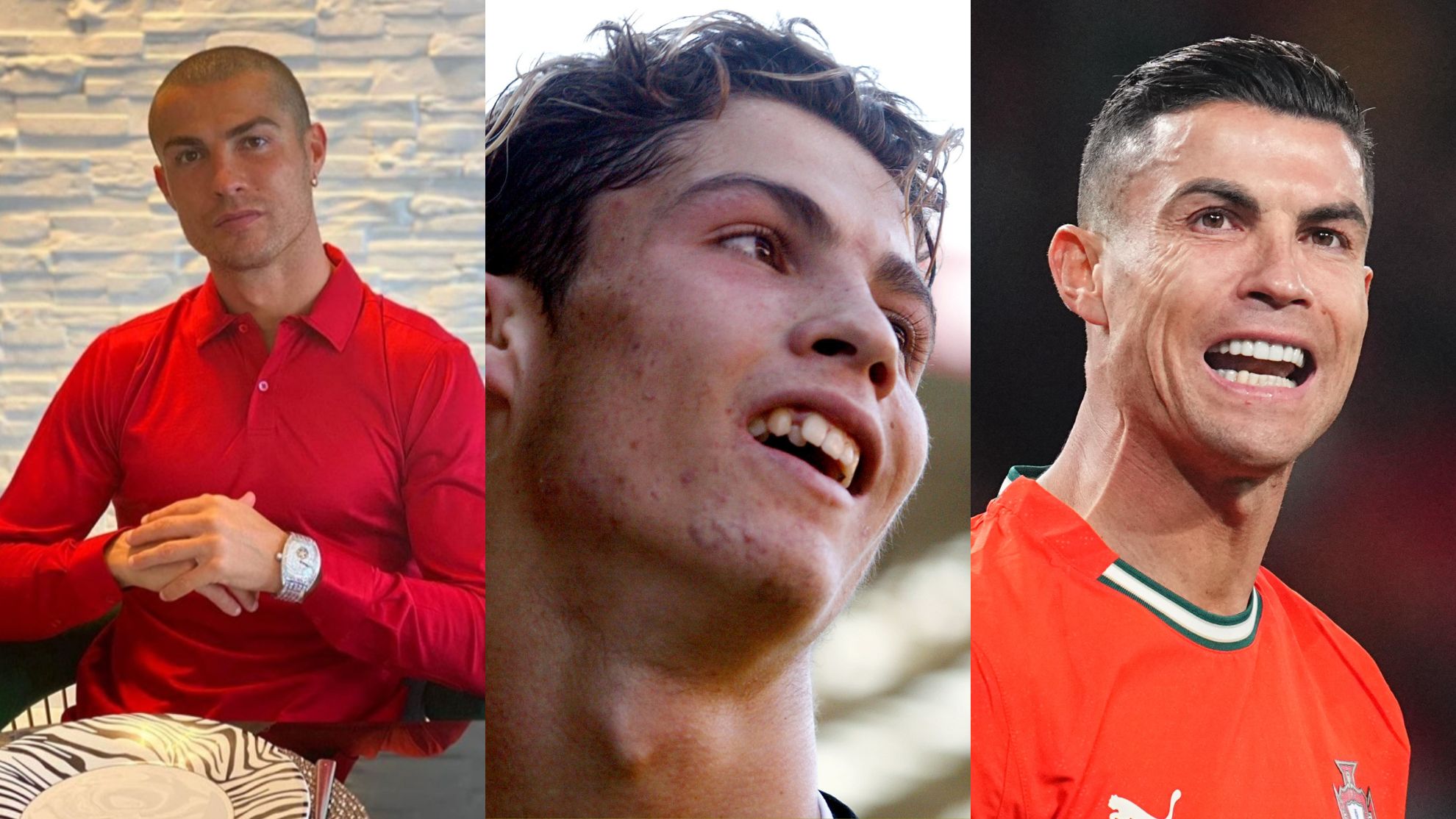 Cristiano Ronaldo bardzo się zmienił. Chodzi ponoć nie tylko o zęby