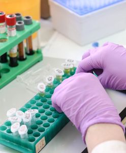 Śląskie. Potrzebne wsparcie, mogą je dać ozdrowieńcy