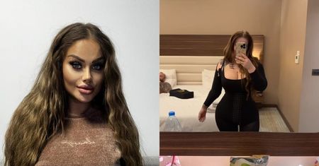 Ewel0na chwali się zdjęciami przed i po operacji: "Jest po prostu TOTALNY SZTOS" (FOTO)