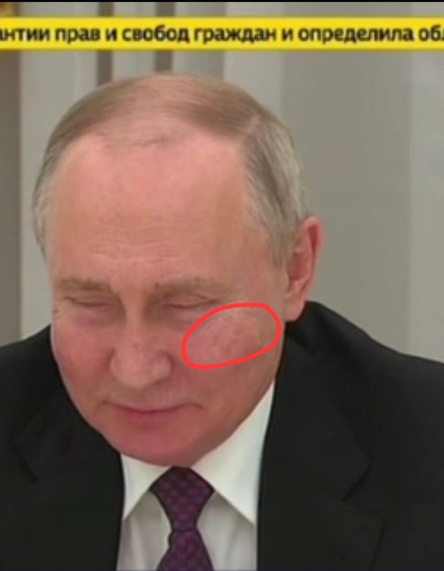 Vladimir Putin or his double with visible signs of plastic surgery