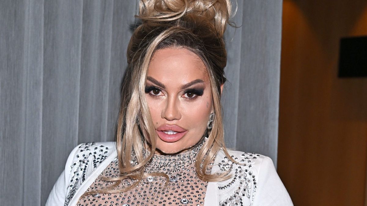 Laluna psioczy na klinikę po operacji bariatrycznej. "To był NAJWIĘKSZY BŁĄD w moim życiu"
