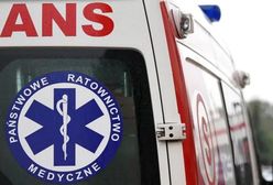 Nieudany eksperyment. Dziecku zapaliły się włosy