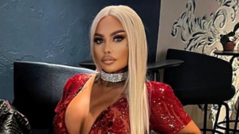 Laluna Unique prezentuje NOWĄ TWARZ i chwali się finalnym efektem tureckiej operacji