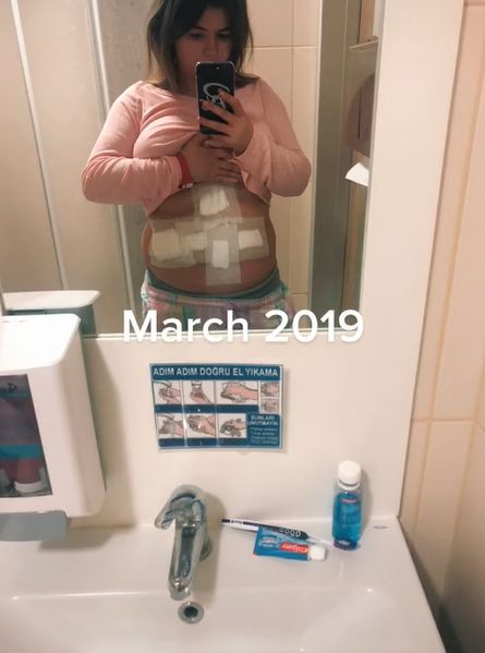 Robyn Bryant schudła 45 kilogramów