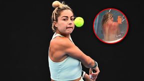 "To nie żart". Tenisistka pokazała przerażające zdjęcie