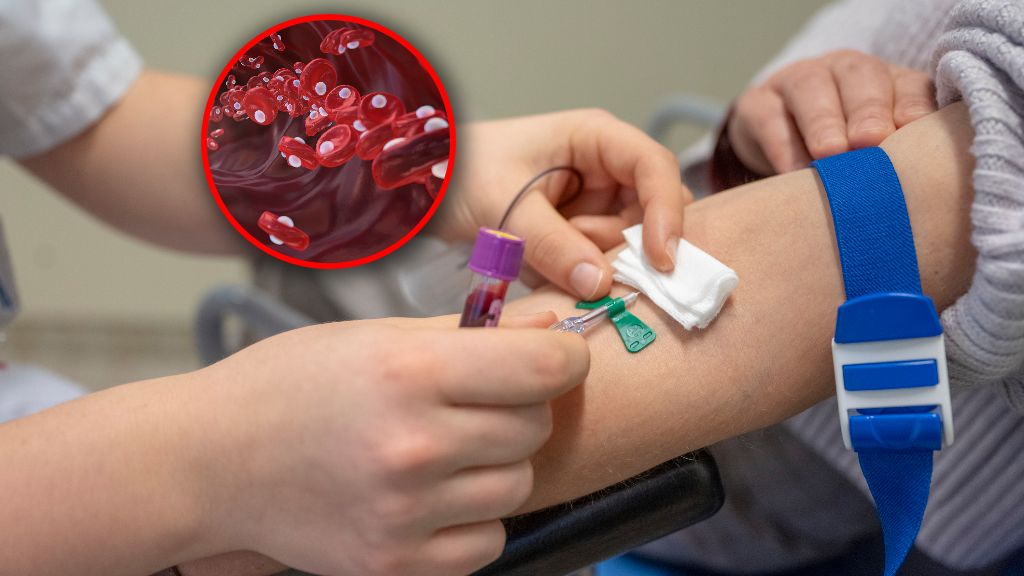 Hemoglobina to białko zawierające żelazo