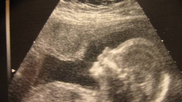 Modyfikacje genetyczne w służbie ekologii. Pomysły szalonego bioetyka? 1