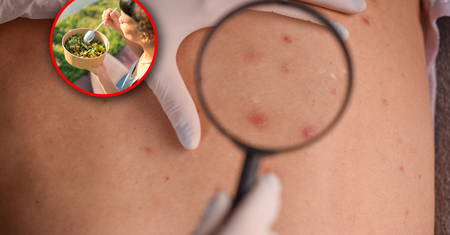 Dieta bogata w błonnik może wspomagać walkę z czerniakiem. "Nowe możliwości"
