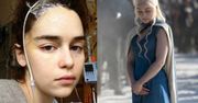 Emilia Clarke ma kompleksy po operacjach mózgu. "Nie chciałam patrzeć na swoją twarz"