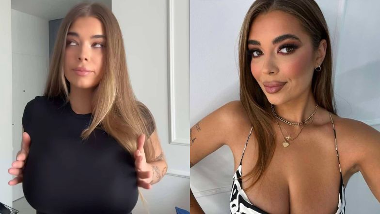 Kori z "Hotelu Paradise" zmniejszyła biust