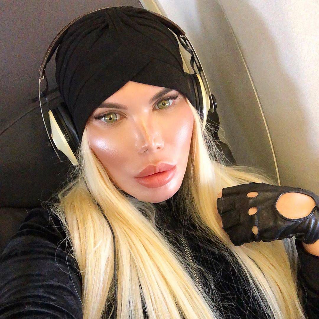Rodrigo Alves po zmianie płci