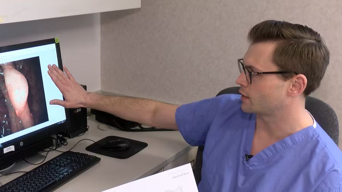 Ten rak jest coraz częstszy u młodych. Poznaj główne objawy