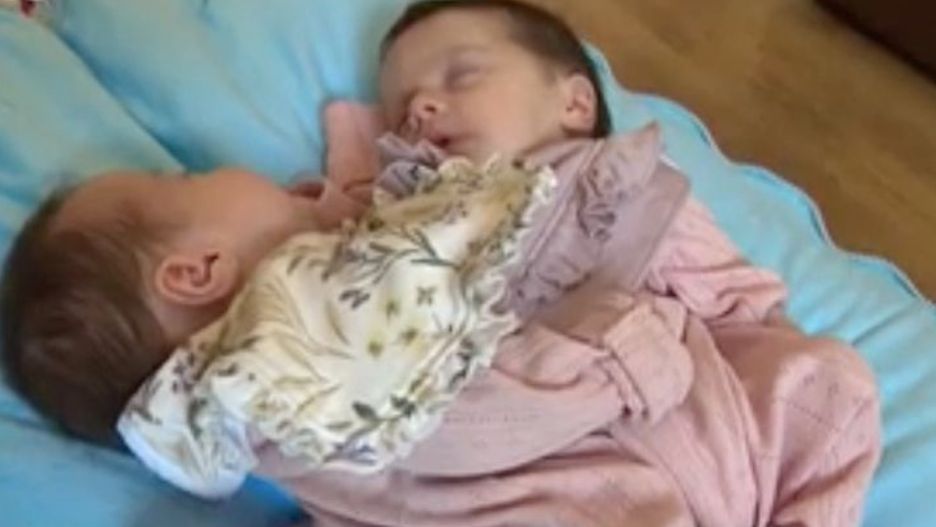 Bliźniaczki, które ''ciągle się przytulają''