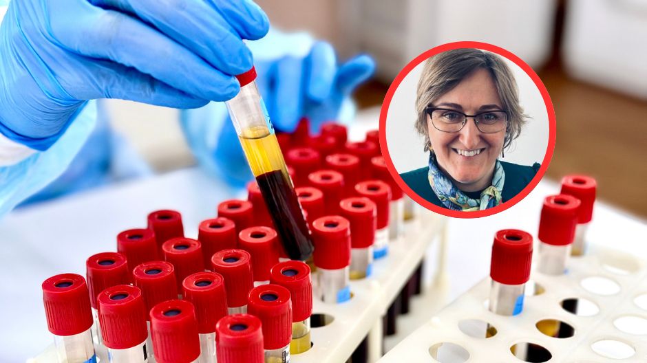 Naukowcy odkryli nowy mechanizm raka. Komórki odpornościowe mogą wspierać rozwój nowotworu