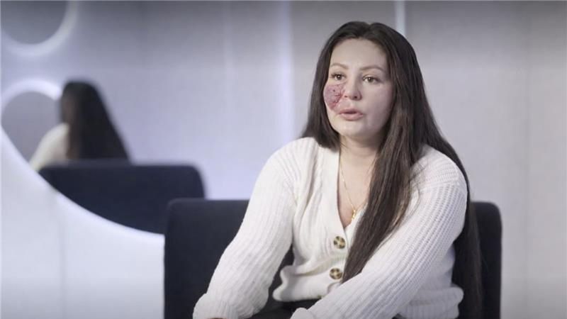 Marta przeszła metamorfozę w programie "Anatomia piękna"