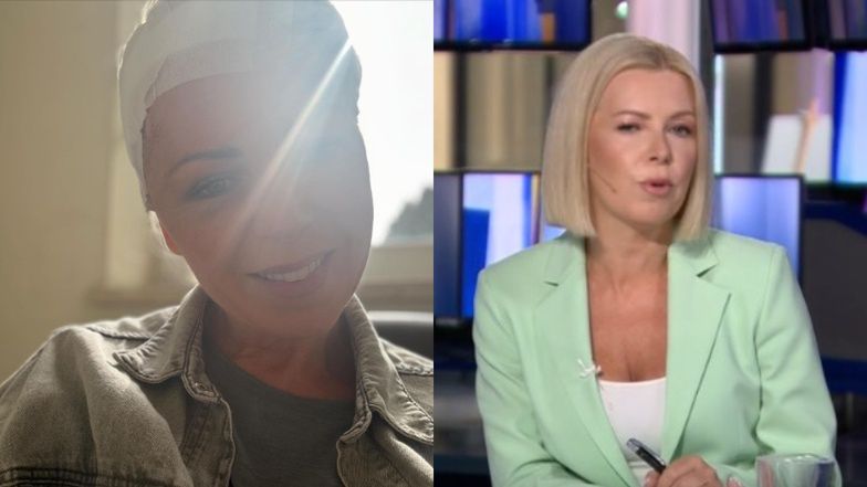 Joanna Kryńska wróciła do pracy po operacji guza mózgu