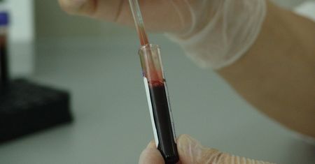 Przełom w diagnostyce raka jelita grubego? Wystarczy krew