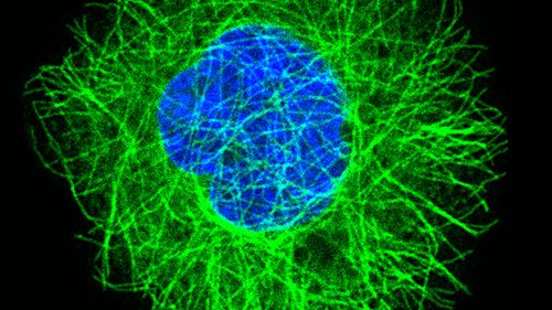 Endoskop z jednej nanorurki 1