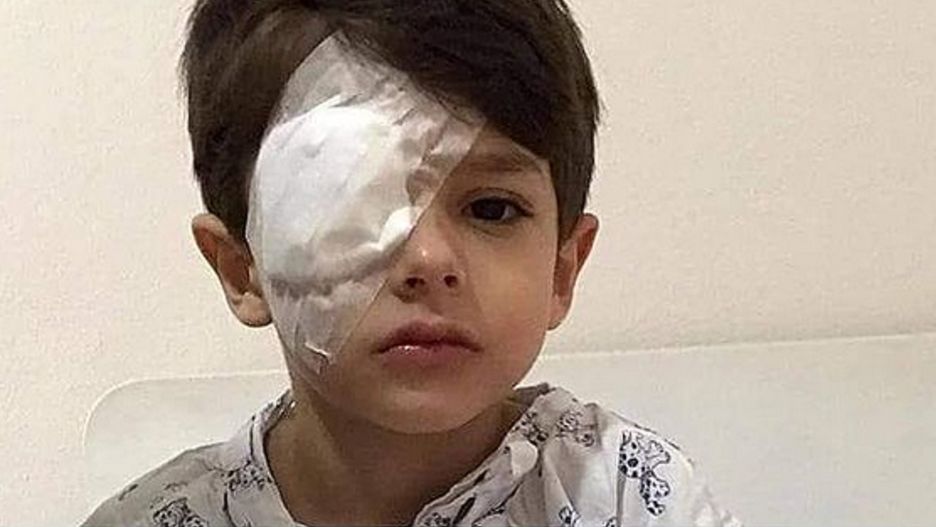 Żel do dezynfekcji spalił mu rogówkę. Chłopiec trafił do szpitala