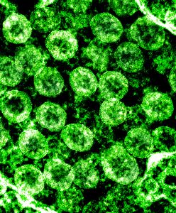 Nowa mutacja COVID-19 w Brazylii. "Jest odporna na przeciwciała"
