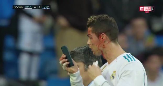 ZALANY KRWIĄ Ronaldo sprawdza swój wygląd na telefonie