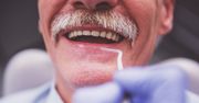 Stan zębów a choroba Alzheimera. Naukowcy odkryli zależność