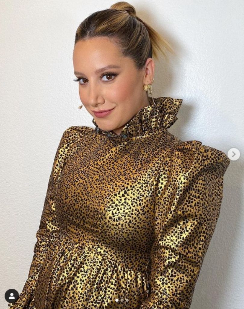 Ashley Tisdale z "High School Musical" wspomina negatywne komentarze po operacji nosa