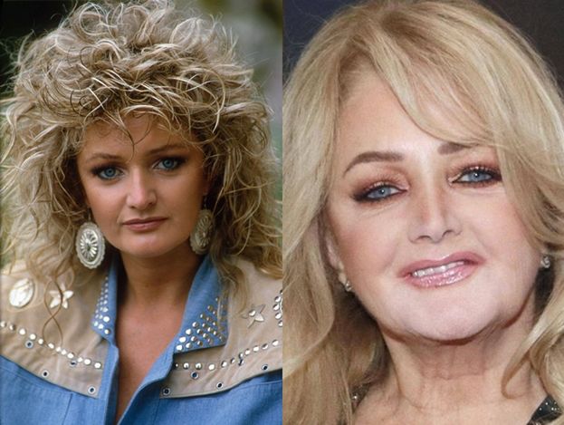 Bonnie Tyler z nową twarzą robi selfie na ściance (FOTO)