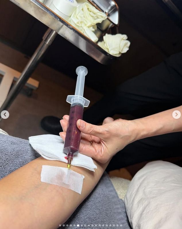 Kim Karadashian podczas zabiegu