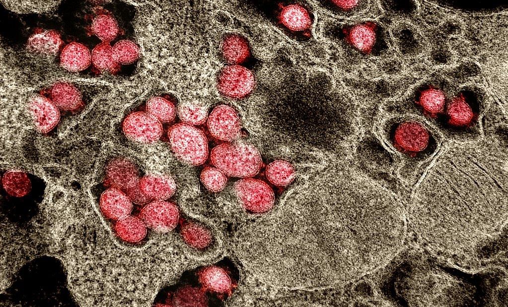 Koronawirus to dopiero początek? Naukowcy ostrzegają przed bardziej niebezpiecznymi pandemiami