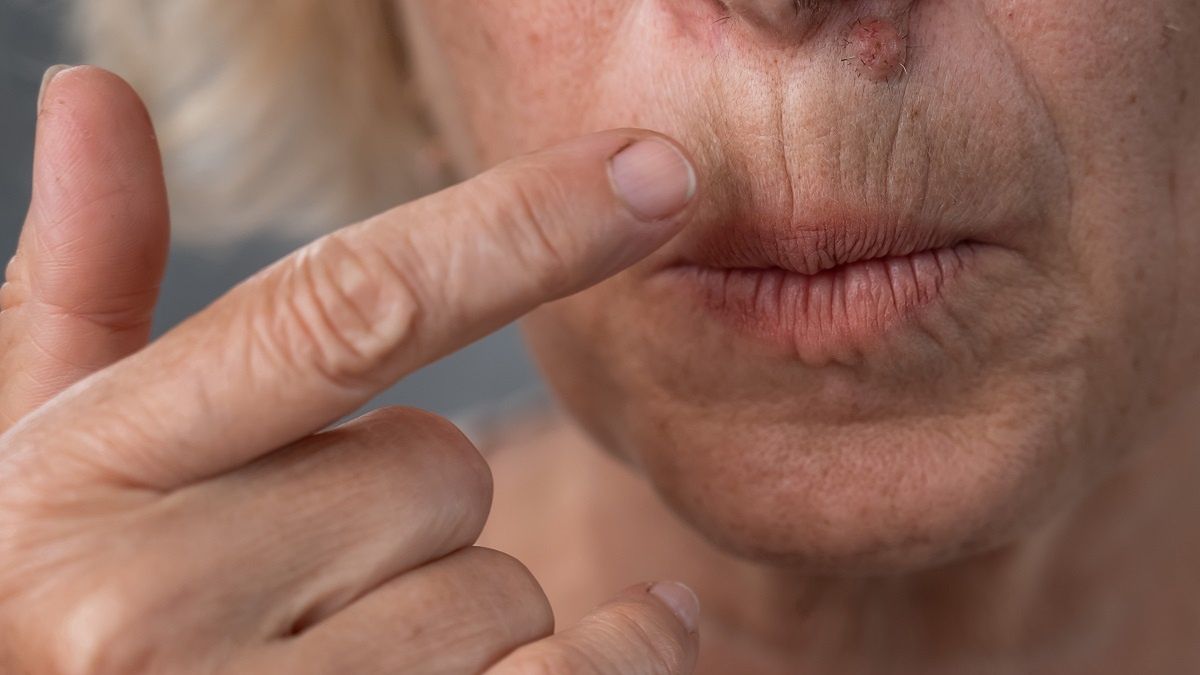 Jak woda brzozowa działa na skórę i włosy?