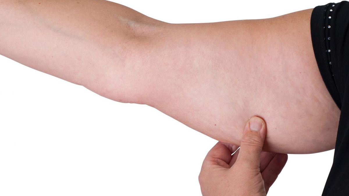 Obwisła skóra na ramionach to wynik braku odpowiednich ćwiczeń. Oto kilka przykładów ćwiczeń, aby móc się z tym uporać