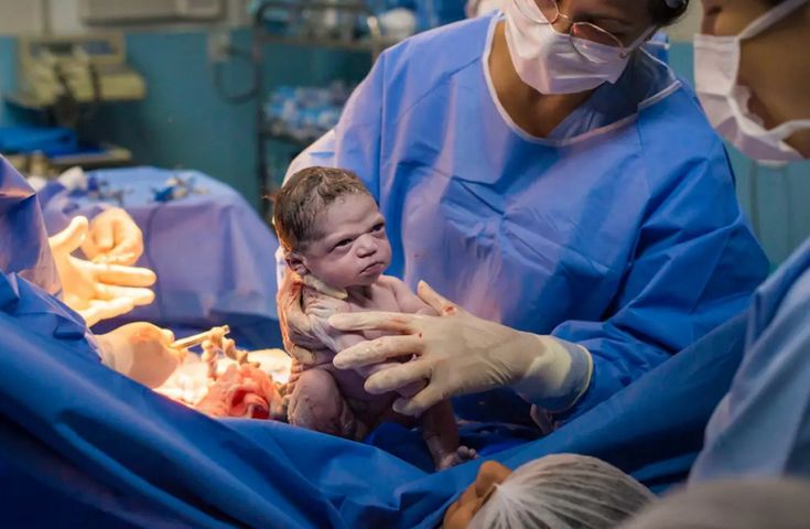 Lekarze wybuchnęli śmiechem na jej widok. "Wściekły noworodek" ma już trzy lata