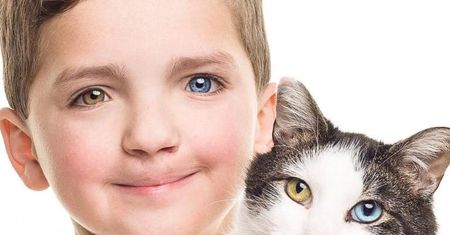 Ma oczy w różnych kolorach. Niezwykły chłopiec z Oklahomy spotkał przyjaciela, który jest jak on