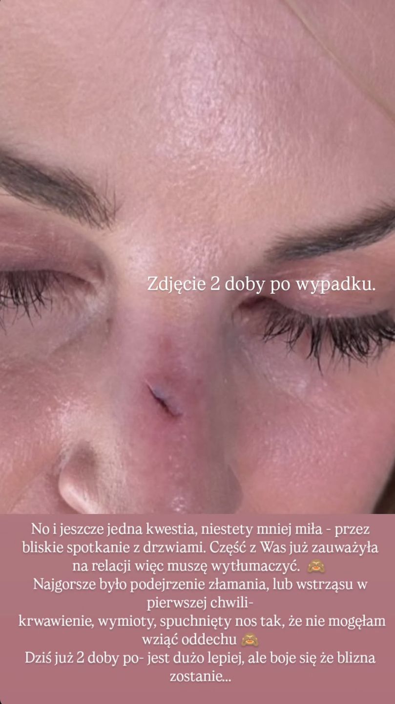 Anita Szydłowska 