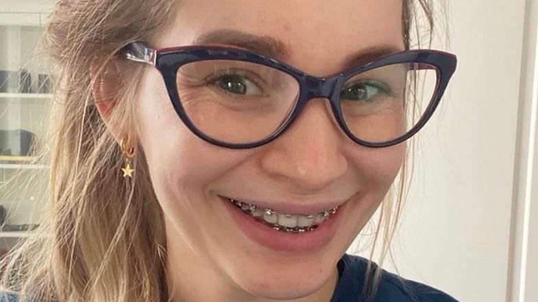 Ewelina Lisowska odpiera zarzuty o korzystanie z chirurgii plastycznej 