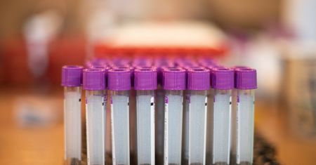 Bakteria New Delhi w szpitalu w Jarosławiu. "Wdrożono działania epidemiologiczne"