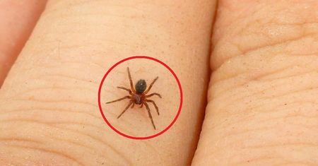 USA. Zauważyła, że wyskoczył jej pryszcz. 10 dni później walczyła o życie